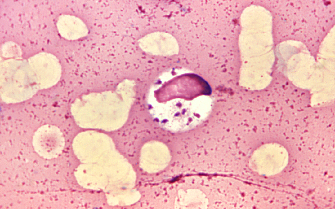 El reto inmunológico con promastigotes de Leishmania (Viannia)  panamensis en Galleria mellonella modula cambios en los perfiles de  expresión de proteínas de bajo peso molecular