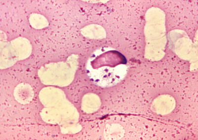 El reto inmunológico con promastigotes de Leishmania (Viannia)  panamensis en Galleria mellonella modula cambios en los perfiles de  expresión de proteínas de bajo peso molecular